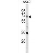 DEAD (Asp-Glu-Ala-Asp) Box Polypeptide 28 (DDX28) Antibody