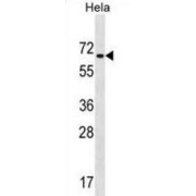 Zinc Finger Protein 35 (ZNF35) Antibody