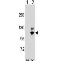 Guanine Nucleotide Binding Protein Like Protein 2 (GNL2) Antibody
