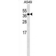 Homeobox Protein Hox-D4 (HOXD4) Antibody