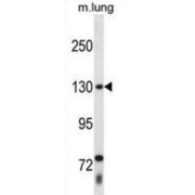 Thyroid Hormone Receptor Associated Protein 3 (THRAP3) Antibody