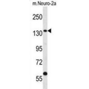 Centrobin, Centriole Duplication And Spindle Assembly Protein (CNTROB) Antibody