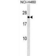 abx028854