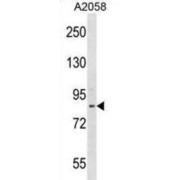 abx028855