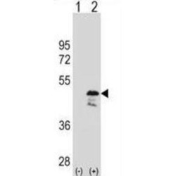 Obg-Like ATPase 1 (OLA1) Antibody