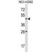 Actin Like 7B (ACTL7B) Antibody