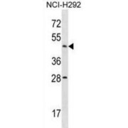 Actin Like 7B (ACTL7B) Antibody