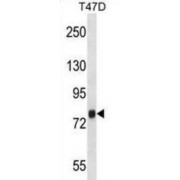 Zinc Finger CCCH Domain-Containing Protein 14 (ZC3H14) Antibody