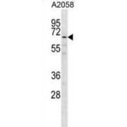 G Patch Domain And KOW Motifs-Containing Protein (GPKOW) Antibody