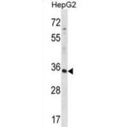 Beta-1,3-N-Acetylglucosaminyltransferase Radical Fringe (RFNG) Antibody