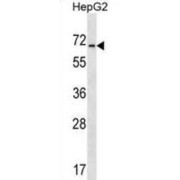 Acid-Sensing Ion Channel 4 (ACCN4) Antibody