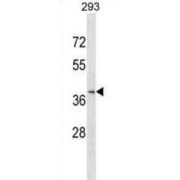 Chemokine C-C-Motif Receptor Like Protein 2 (CCRL2) Antibody