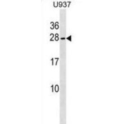 NFKB Inhibitor Interacting Ras Like 2 (NKIRAS2) Antibody