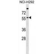 Palmitoyltransferase ZDHHC13 (ZDHHC13) Antibody