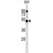 Kelch Domain Containing Protein 4 (KLHDC4) Antibody