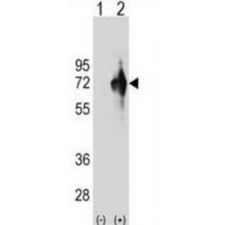 Kelch Domain Containing Protein 4 (KLHDC4) Antibody
