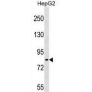 WB analysis of HepG2 cell lysates.