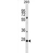 Pleckstrin Homology And FYVE Domain Containing 1 (PLEKHF1) Antibody