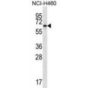 Zinc Finger And BTB Domain-Containing Protein 46 (ZBTB46) Antibody