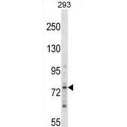 Zinc Finger Protein 81 (ZNF81) Antibody