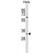 3(2),5-Bisphosphate Nucleotidase 1 (BPNT1) Antibody