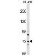 Myotubularin Related Protein 6 (MTMR6) Antibody