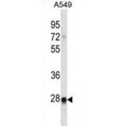 WB analysis of A549 cell line lysates.