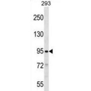 SLIT And NTRK-Like Protein 2 (SLITRK2) Antibody