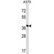 2-(3-Amino-3-Carboxypropyl)histidine Synthase Subunit 1 (DPH1) Antibody