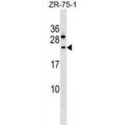 Coiled-Coil Domain-Containing Protein 140 (CCDC140) Antibody