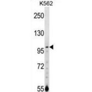 N(Alpha)-Acetyltransferase 15, NatA Auxiliary Subunit (NARG1) Antibody