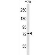 Katanin Regulatory Subunit B1 (KATNB1) Antibody