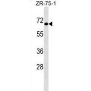 General Transcription Factor 3C Polypeptide 5 (GTF3C5) Antibody