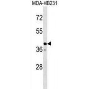 Taste Receptor Type 2 Member 31 (TAS2R31) Antibody