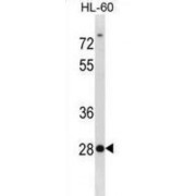 Syntenin-2 (SDCBP2) Antibody