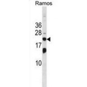 Interferon-Stimulated Gene 20 kDa Protein (ISG20) Antibody