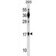 Basic Leucine Zipper Transcriptional Factor ATF-Like (BATF) Antibody