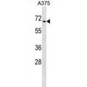 Chromodomain Y-Like Protein (CDYL) Antibody