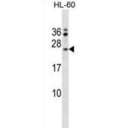 Fas Apoptotic Inhibitory Molecule (FAIM) Antibody