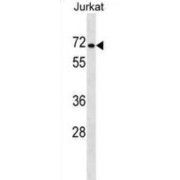 Hydroxyproline Dehydrogenase (PRODH2) Antibody