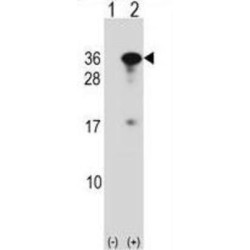 RING1 And YY1 Binding Protein (RYBP) Antibody