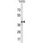 Zinc Finger Protein 124 (ZNF124) Antibody