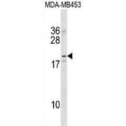 Sodium/potassium-Transporting ATPase Subunit Beta-1-Interacting Protein 2 (NKAIN2) Antibody