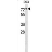 Copine-3 (CPNE3) Antibody