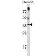 Mitochondrial Ribosome Associated GTPase 1 (MTG1) Antibody