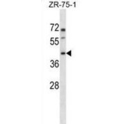 WB analysis of ZR-75-1 cell line lysates.