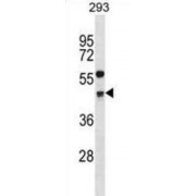Cyclin-G2 (CCNG2) Antibody