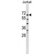 Zinc Finger Protein 498 (ZNF498) Antibody