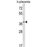 Ubiquitin-Conjugating Enzyme E2 Q2 (UBE2Q2) Antibody