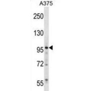 Zinc Finger Protein 541 (ZNF541) Antibody